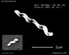 Campylobacter jejuni electron microscopy